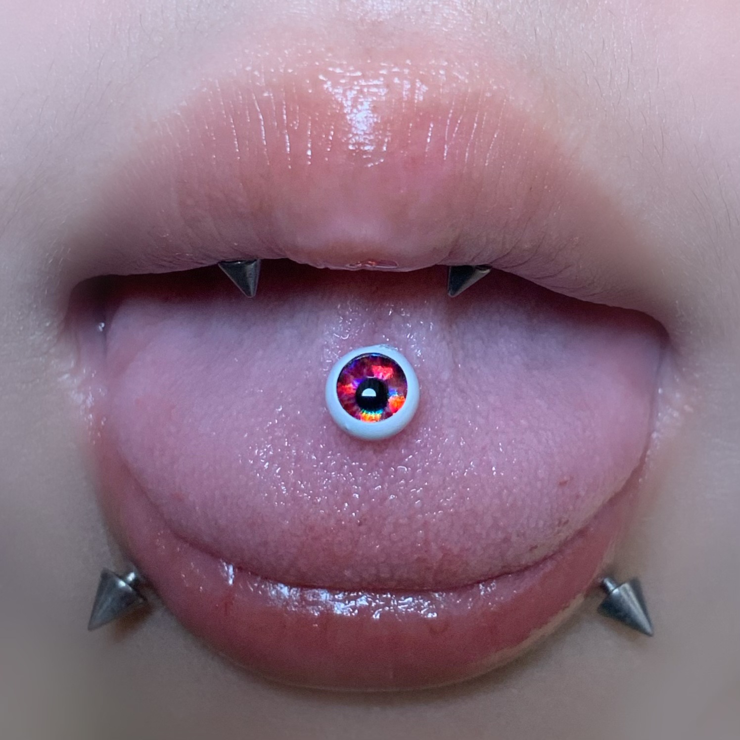 Img